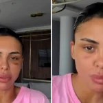 Andreea Popescu, transformare după ce a slăbit 20 de kilograme. Ce operații estetice și-a făcut și cum a decurs recuperarea