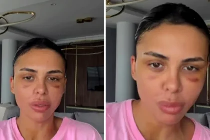 Andreea Popescu, transformare după ce a slăbit 20 de kilograme. Ce operații estetice și-a făcut și cum a decurs recuperarea