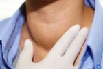 Nodulii tiroidieni pot fi tratați și fără operație în anumite cazuri. Dr. Ionuț Sandu explică metoda minim invazivă