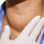 Nodulii tiroidieni pot fi tratați și fără operație în anumite cazuri. Dr. Ionuț Sandu explică metoda minim invazivă